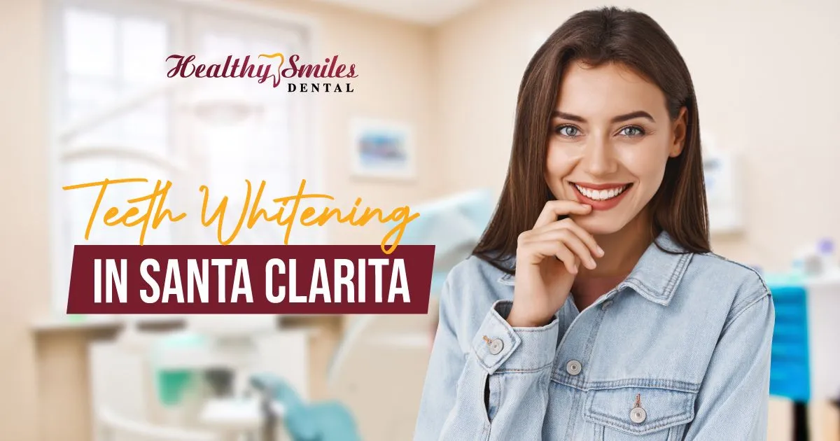 24787 at home teeth whitening santa clarita