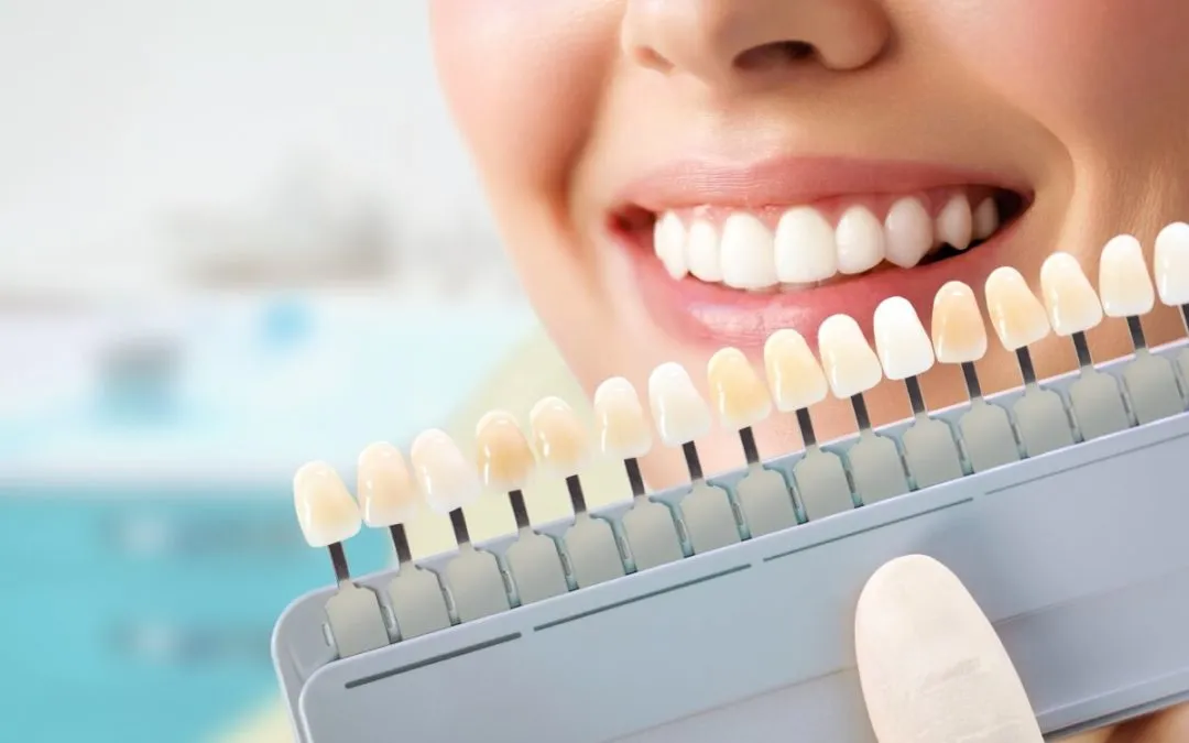 24800 take home teeth whitening
