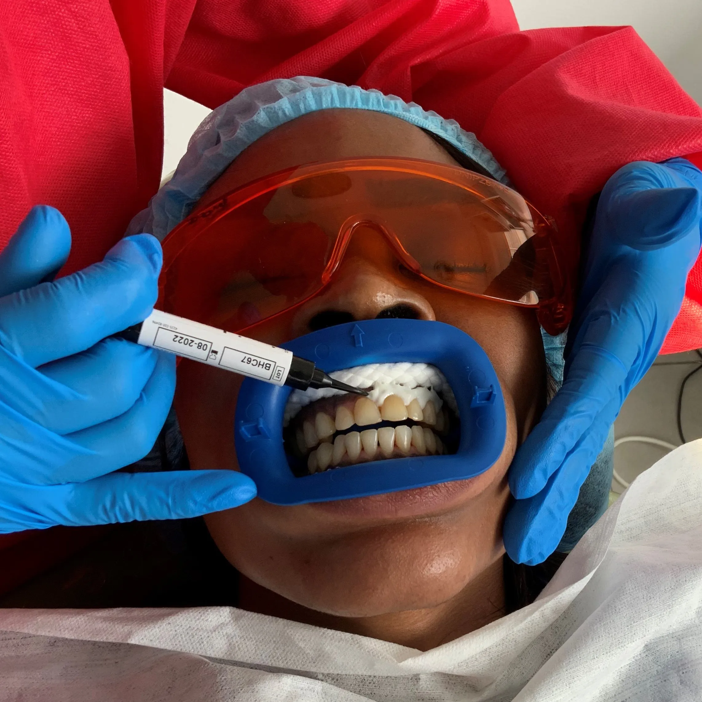 24809 professional whitening
