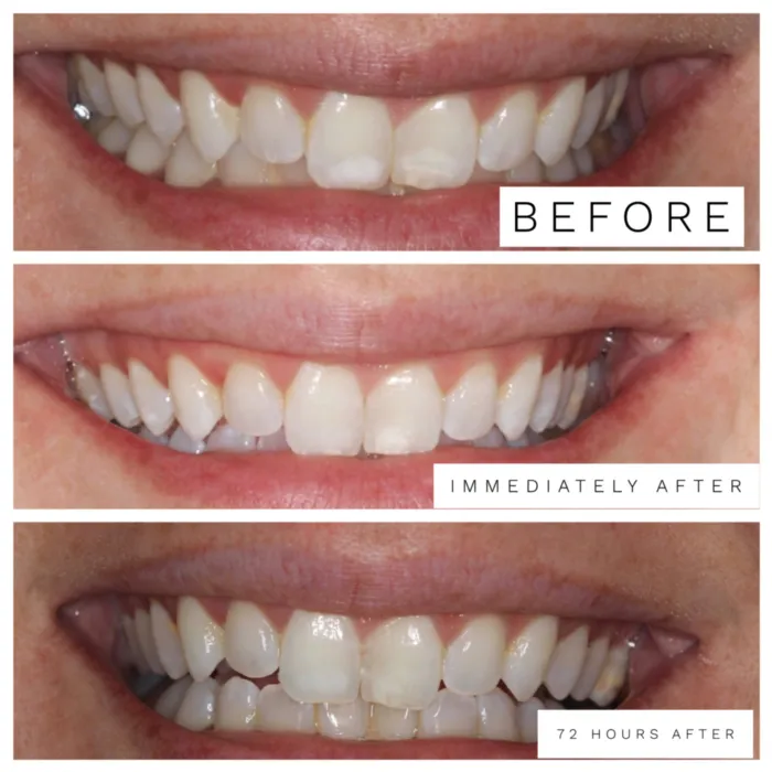 24811 orthodontist consultation image4
