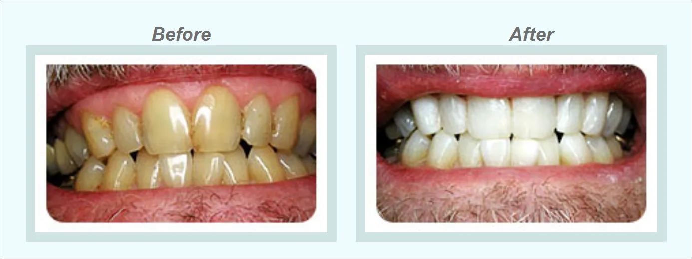 24812 dental checkup