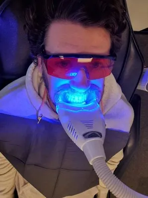 /img/24816-teeth-whitening-process.webp