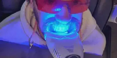 /img/24816-teeth-whitening-process.webp