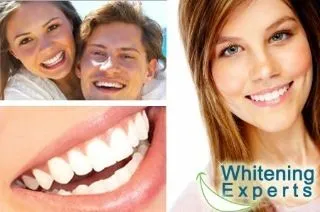 24818 teeth whitening results