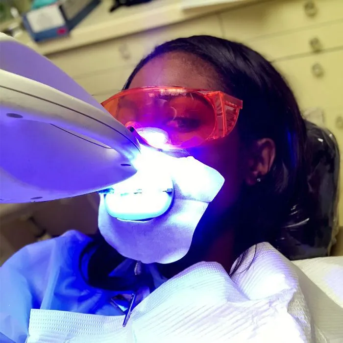 /img/24818-teeth-whitening-smile.webp