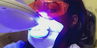 /img/24818-teeth-whitening-smile.webp