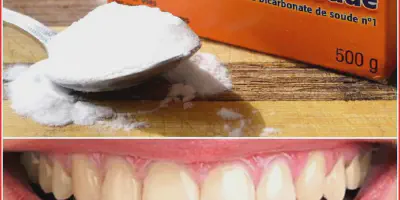 /img/24822-healthy-smile.webp