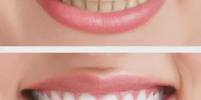 /img/24828-dayton-teeth-whitening-smiling-woman.webp