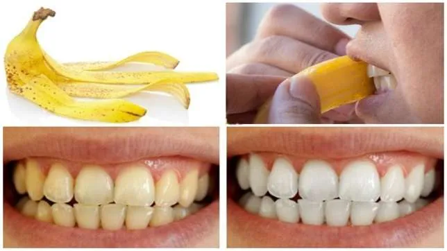 /img/24830-banana-peel-teeth-whitening-7.webp