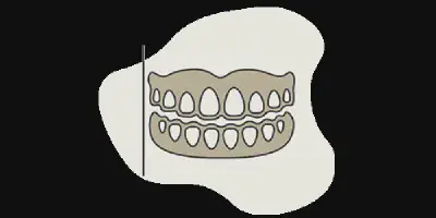 /img/24840-teeth-whitening-results.webp
