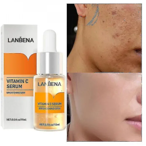 24841 reduced inflammation