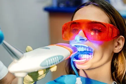 24843 teeth whitening customized