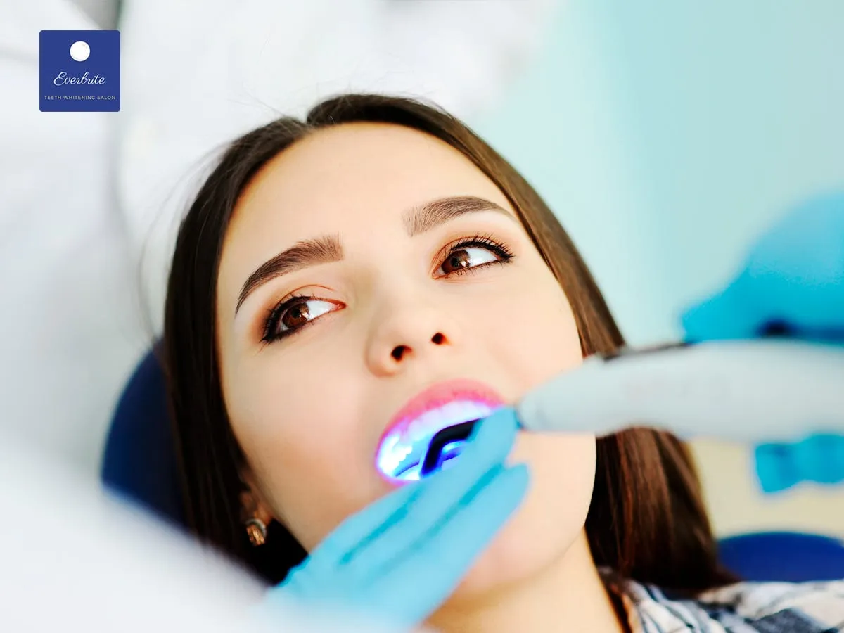 24843 teeth whitening results