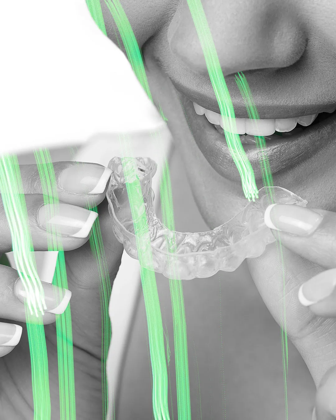 24845 teeth whitening before after
