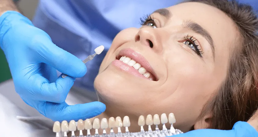 24849 aesthetic teeth whitening