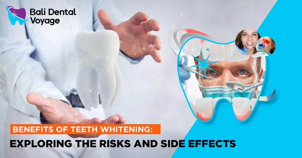 24849 professional teeth whitening