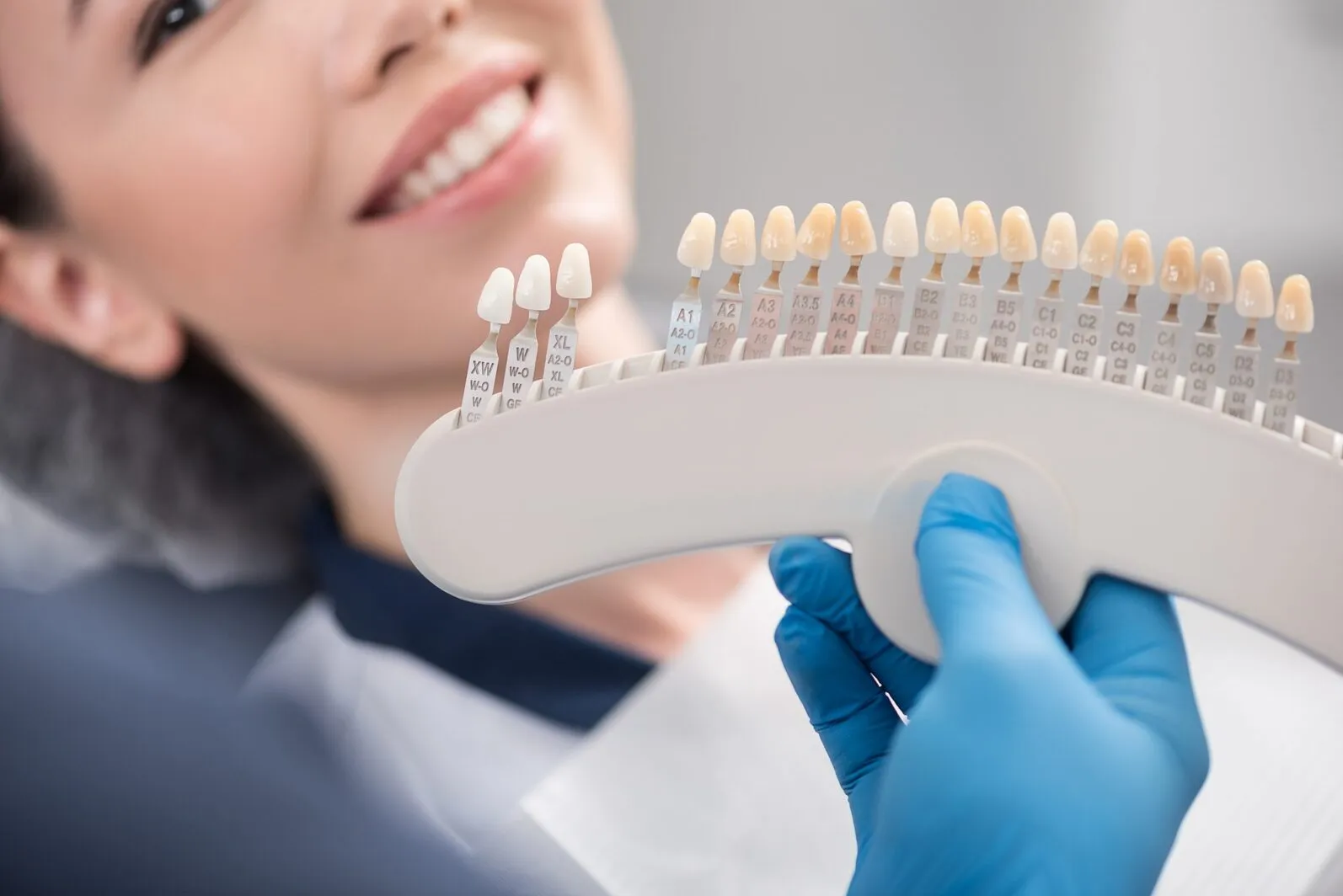 24849 teeth whitening before after