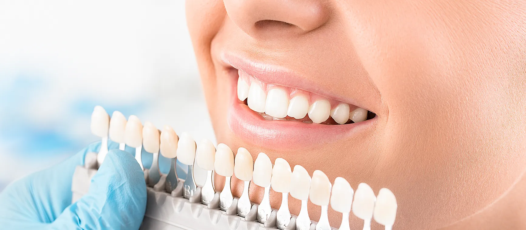 24855 teeth whitening before after