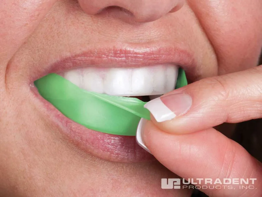 24855 teeth whitening confidence