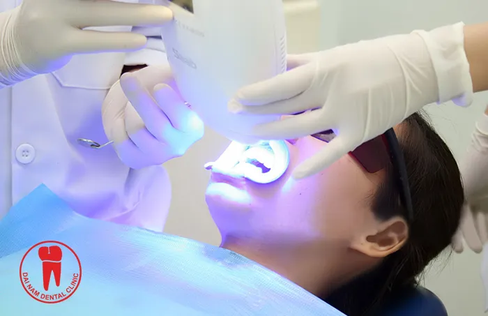 24865 teeth whitening results