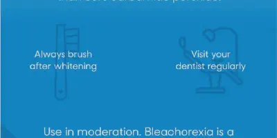 /img/24866-teeth-whitening-comparison.webp