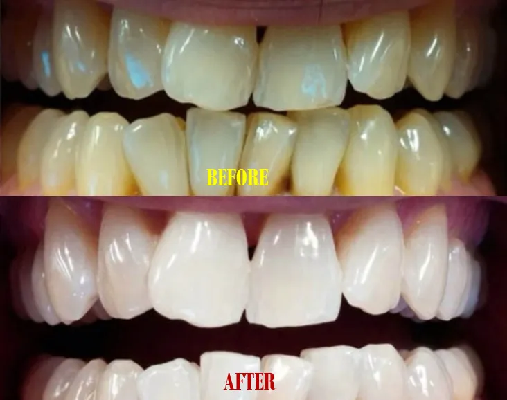 /img/24870-healthy-smile.webp