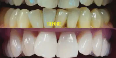 /img/24870-healthy-smile.webp