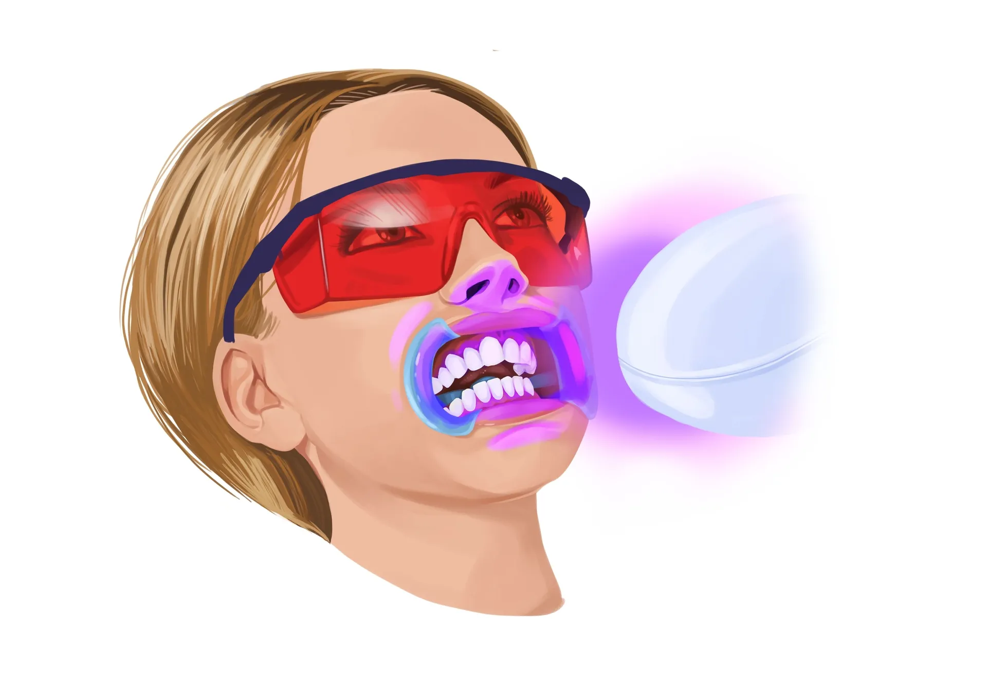 /img/24871-teeth-whitening-aftercare.webp