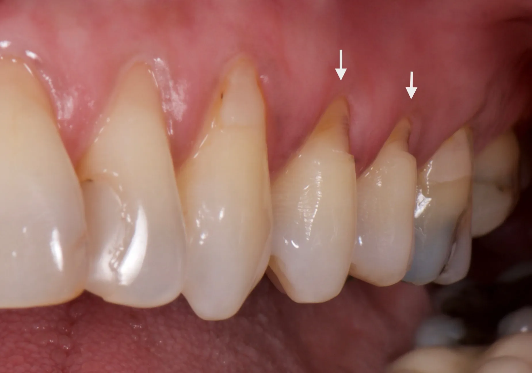 24874 gel concentration
