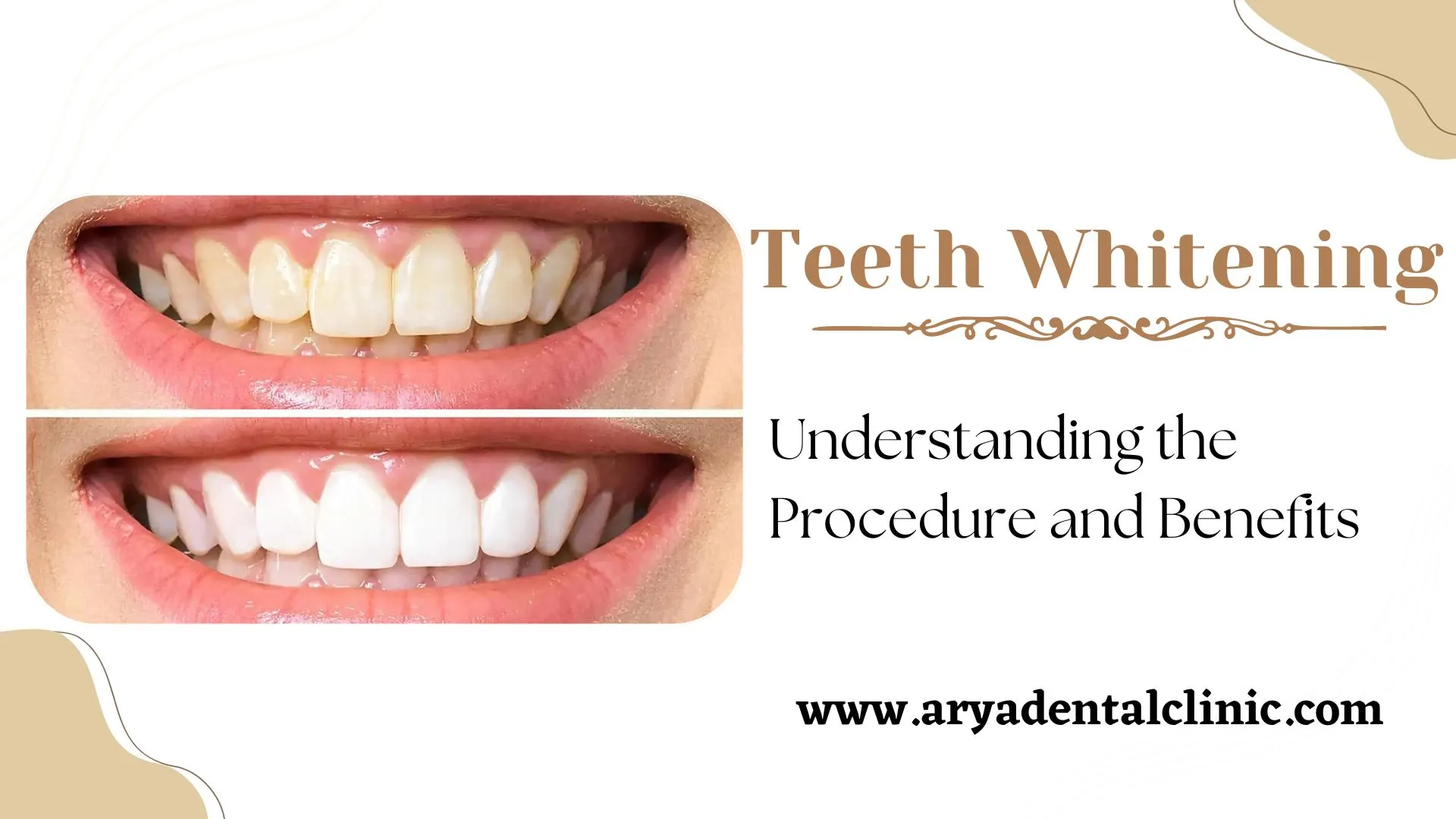 24875 healthy smile