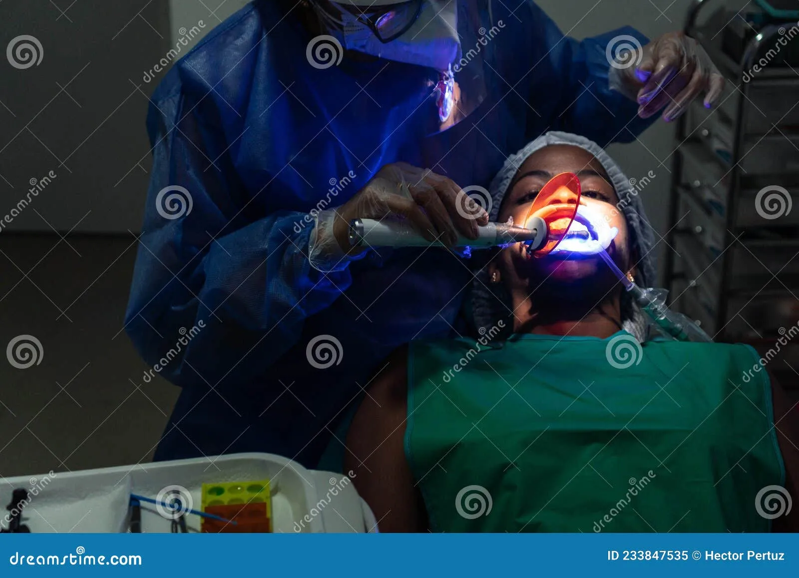 24875 in office whitening