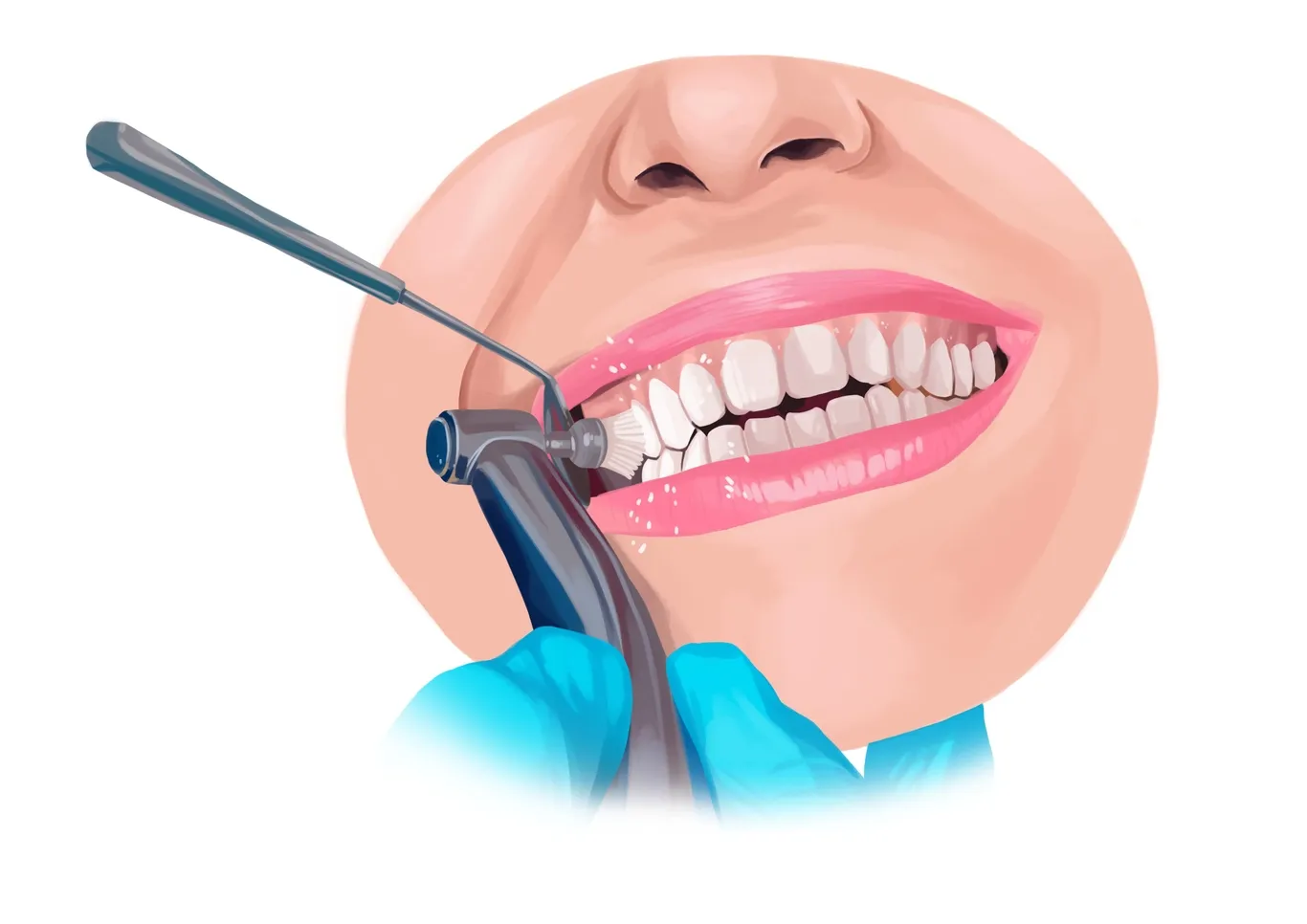 24877 at home teeth whitening