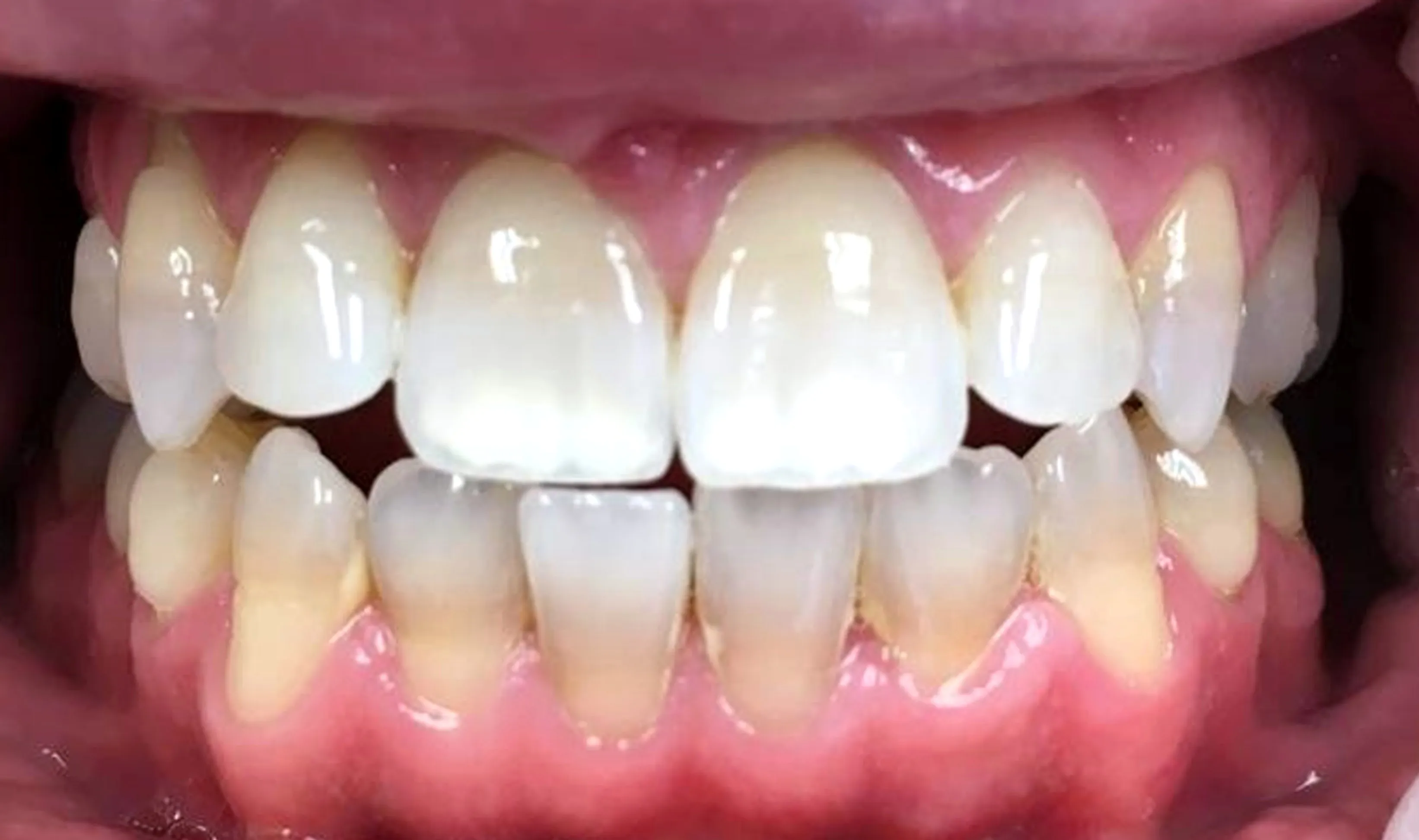 /img/24879-dentist-consultation.webp