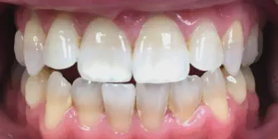/img/24879-dentist-consultation.webp