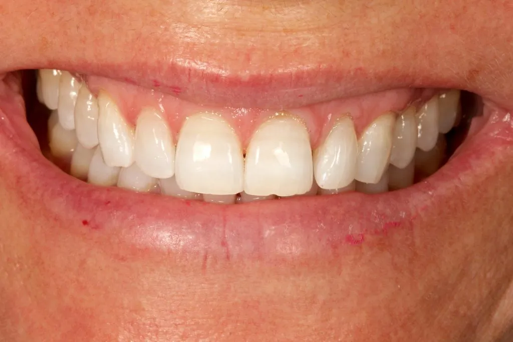 24879 oral hygiene