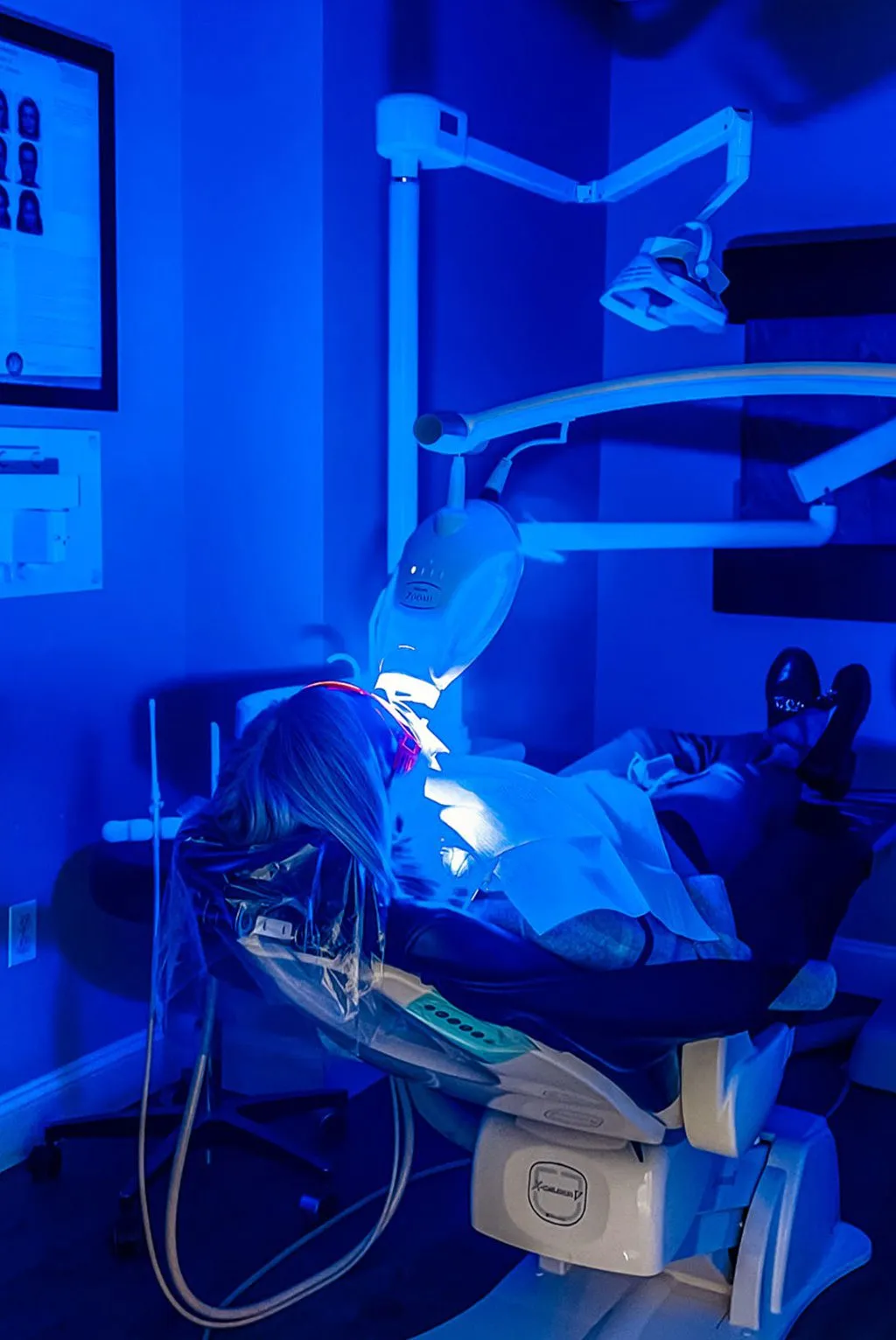24880 in office teeth whitening