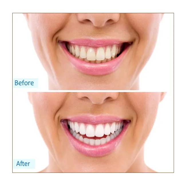 /img/24880-regular-dental-checkups.webp