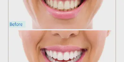 /img/24880-regular-dental-checkups.webp