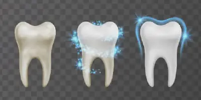 /img/24883-beautiful-smile.webp