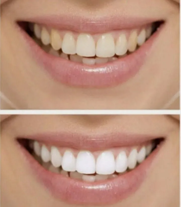 24884 proper brushing technique