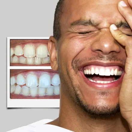 /img/24886-healthy-white-teeth.webp