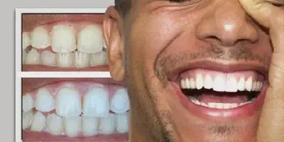 /img/24886-healthy-white-teeth.webp