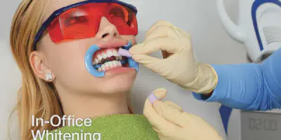 /img/24898-seattle-teeth-whitening-diet.webp