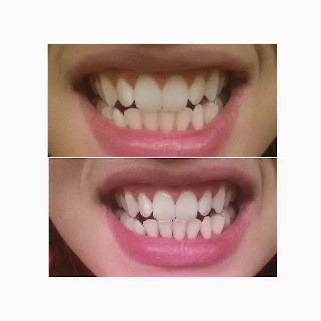 /img/24904-bright-smile.webp