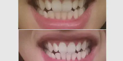 /img/24904-bright-smile.webp