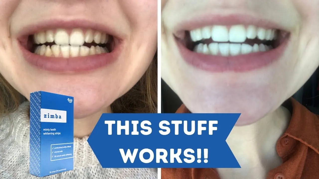 24905 teeth whitening process