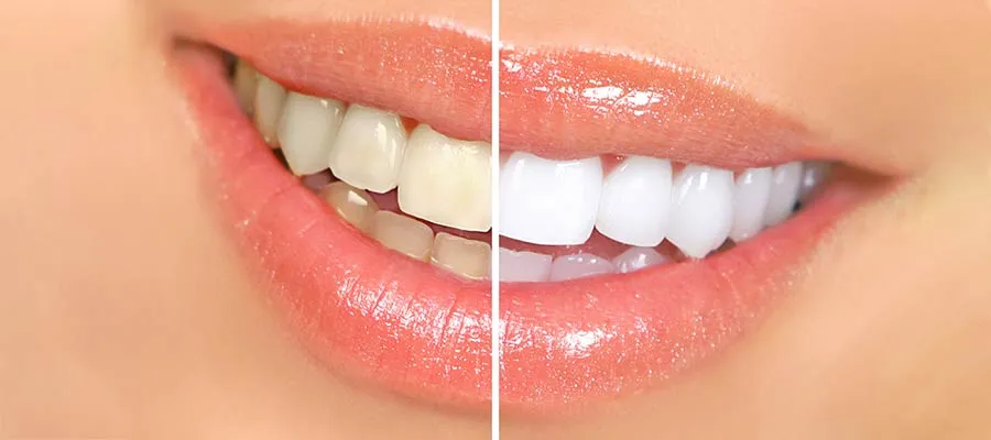 /img/24909-beautiful-smile.webp