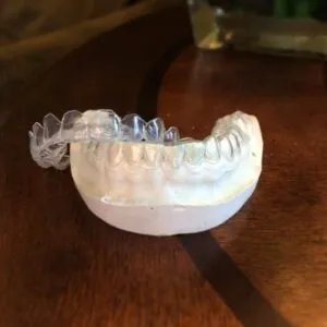 24910 professional teeth whitening