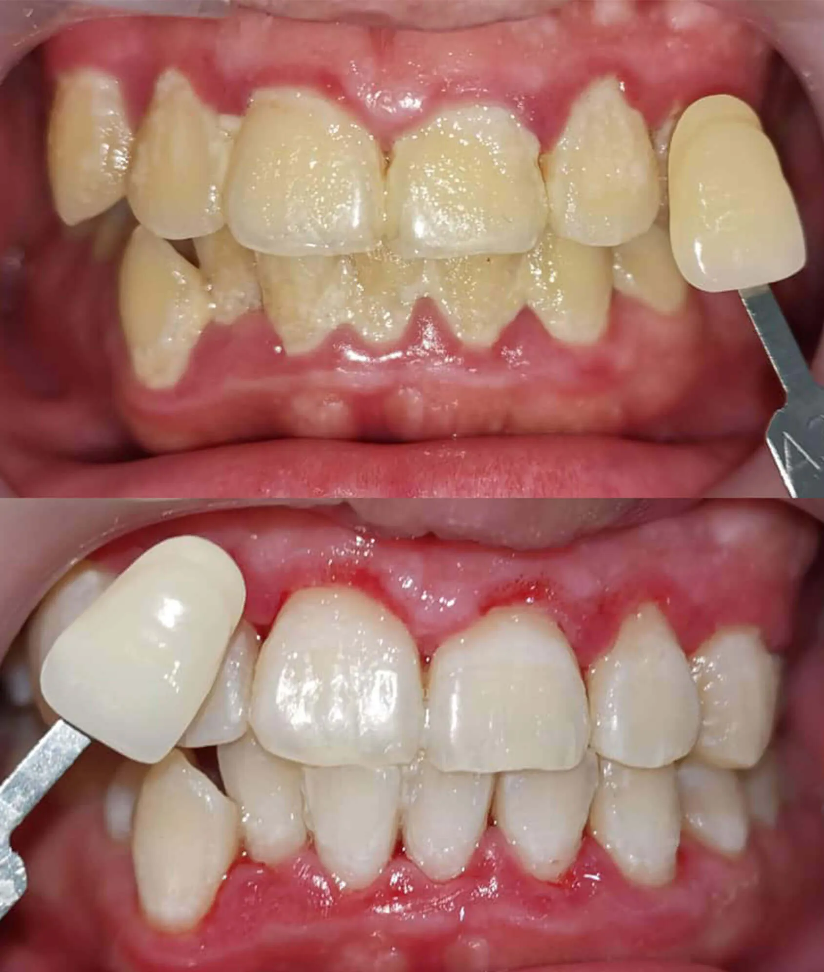 24913 dental clinic jakarta
