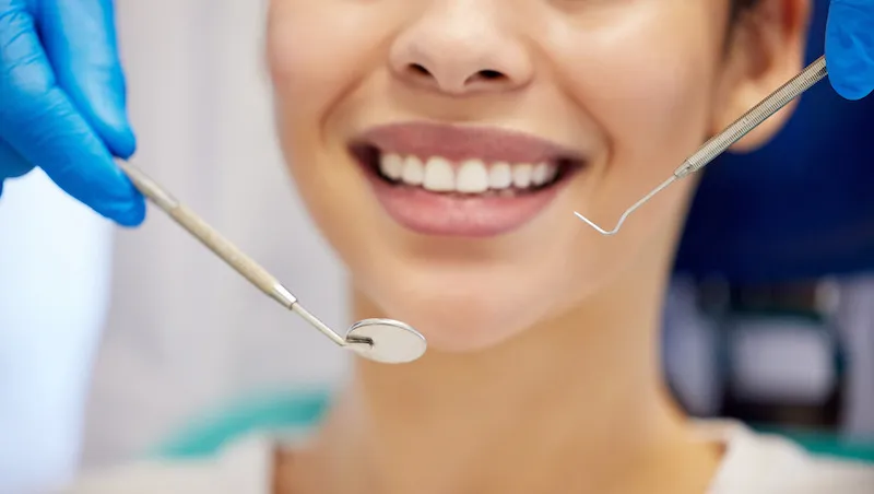 24913 in office teeth whitening